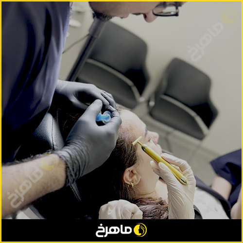 بهترین کلینیک مزوتراپی در گلستان