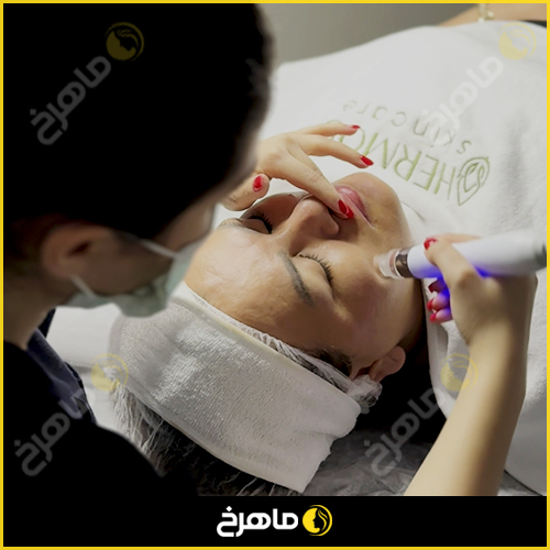 نمونه کار پی آر پی در کلینیک ماهرخ