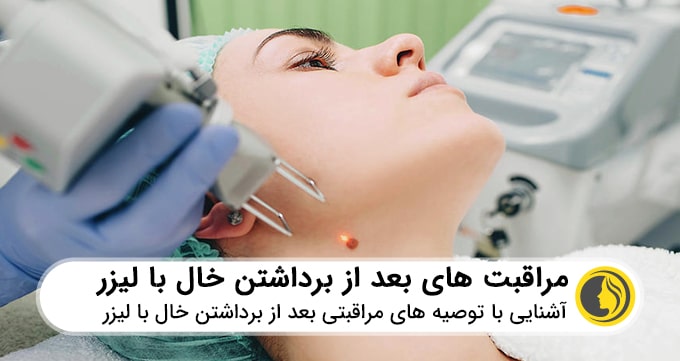 مراقبت های بعد از برداشتن خال با لیزر