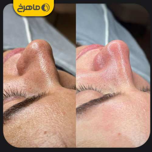 بهترین دکتر جوانسازی صورت در رباط کریم