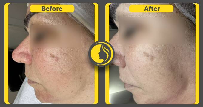 نمونه کار خدمات پوست در کلینیک ماهرخ