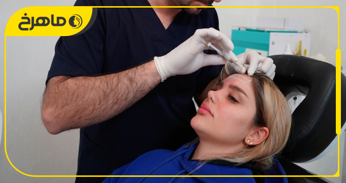 نمونه کار تزریق بوتاکس در کلینیک ماهرخ