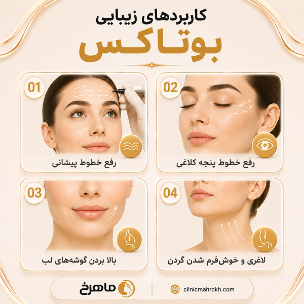 کاربردهای زیبایی بوتاکس