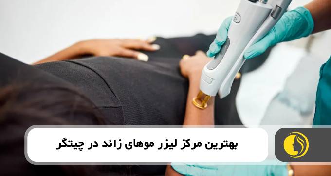 بهترین مرکز لیزر کندلا در چیتگر