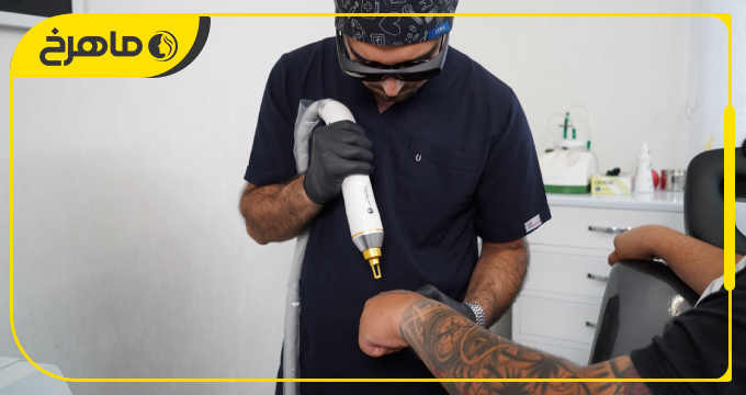 بهترین کلینیک رفع تاتو در اسلامشهر