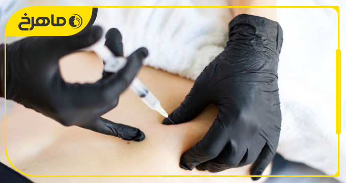 بعد از تزریق فیلر بادی در نازیآباد، چه کارهایی نباید انجام دهیم؟