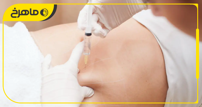 چگونه بهترین دکتر فیلر بادی در جنوب تهران را انتخاب کنیم؟