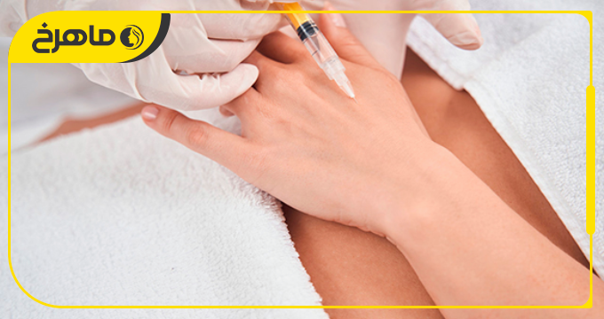 ماندگاری فیلر بدن چقدر است و چه زمانی نیاز به تمدید دارد؟