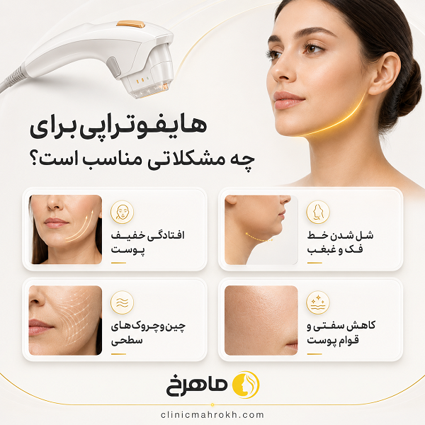ماندگاری نتایج هایفوتراپی صورت چقدر است؟