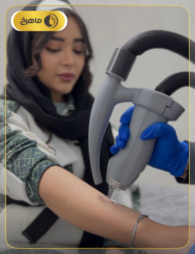 نمونه کار لیزر کلینیک ماهرخ