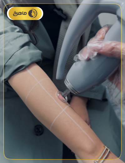 نمونه نمونه کار لیزر کلینیک ماهرخ