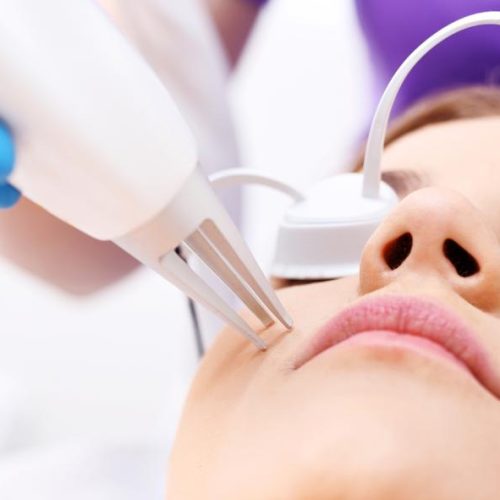 acne-scars-acne-treatment-acne-1